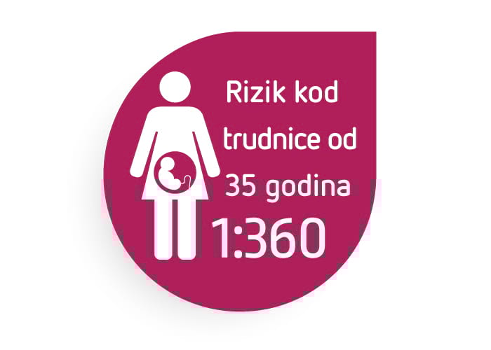 Rrezik për sindromën Down