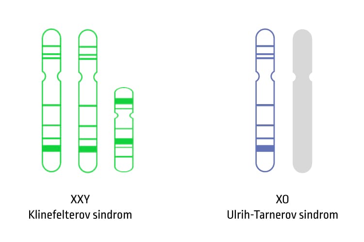 Informacion mbi Çrregullimet e Kromozomeve X/Y